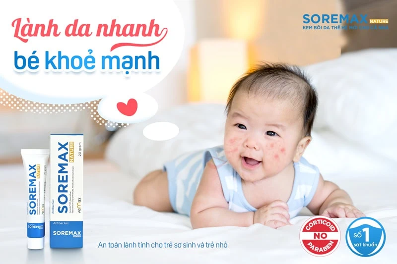 Kem trị hăm tã cho bé Soremax – Sự lựa chọn hàng đầu cho bé