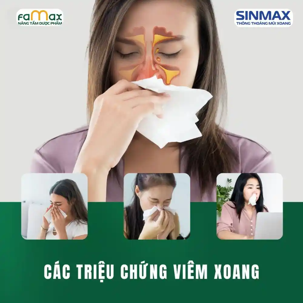 Cac Trieu Chung Viem Xoang 1