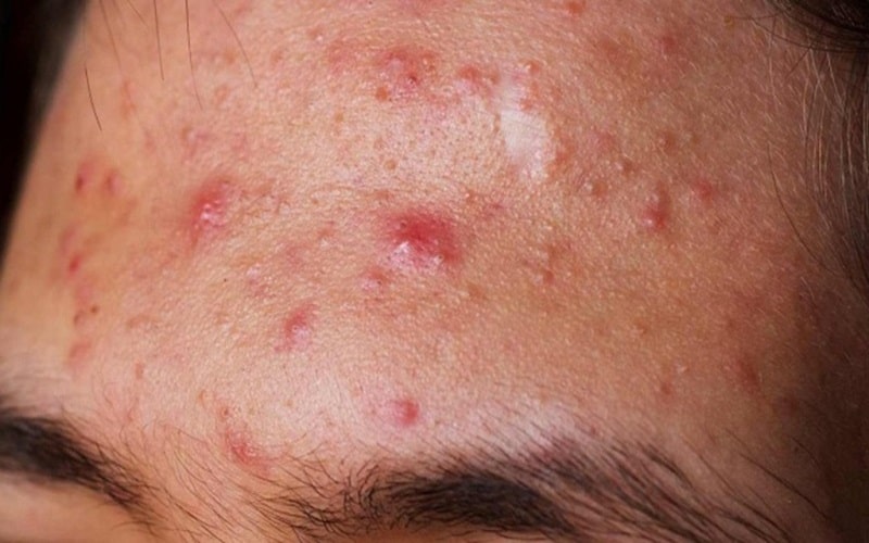 Cách Giải độc Gan Tại Nhà