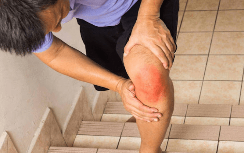 Viêm Khớp Có ăn được Trứng Gà Không
