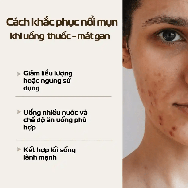 Tai Sao Uong Thuoc Mat Gan Lai Noi Mun 3