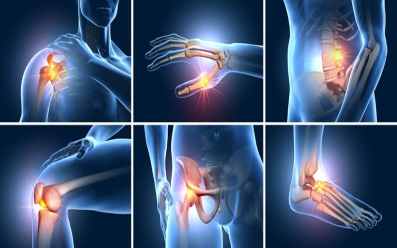 Tác Dụng Phụ Của Thuốc Xương Khớp 1