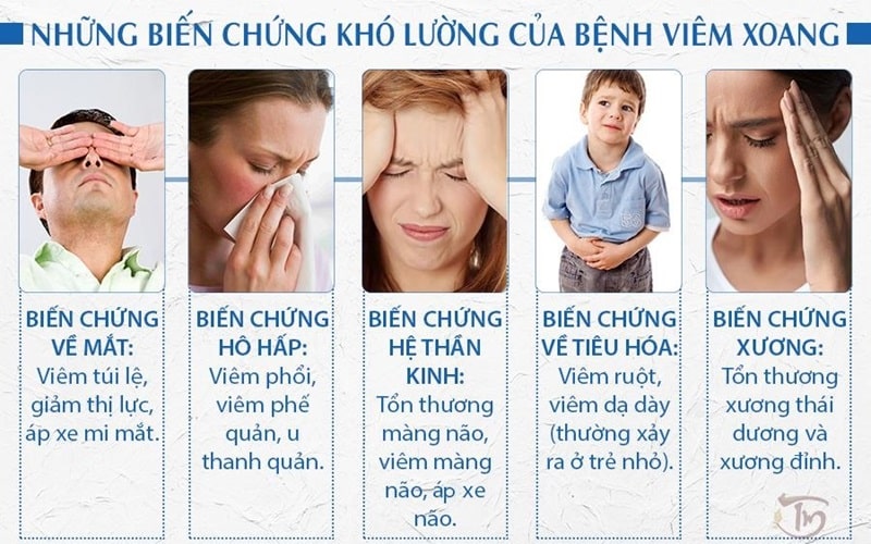 4 Triệu Chứng Viêm Xoang Nặng Nguy Hiểm Nhất 1