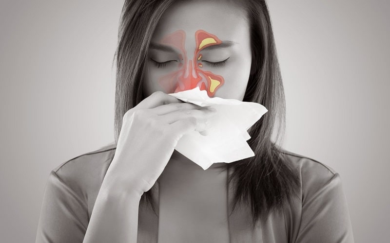 4 Triệu Chứng Viêm Xoang Nặng Nguy Hiểm Nhất