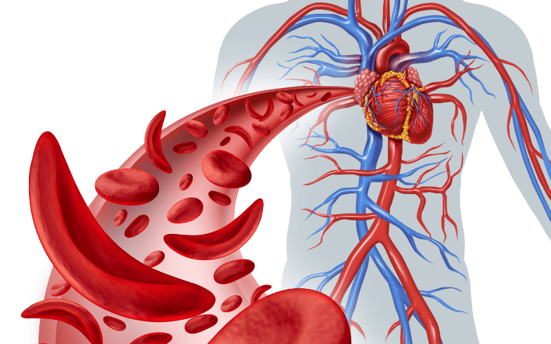 Những người bị tuần hoàn máu kém thường gặp phải nhiều triệu chứng khác nhau Những người bị tuần hoàn máu kém thường gặp phải nhiều triệu chứng khác nhau