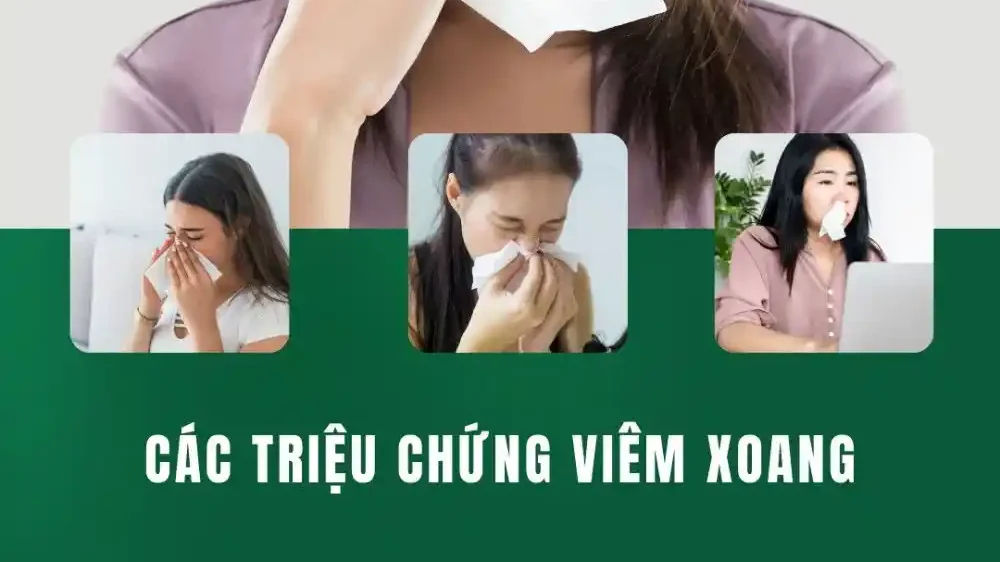 Cac Trieu Chung Viem Xoang 1