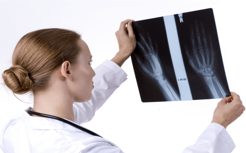 Nguyên Nhân Gây đau Cổ Tay Sau Sinh Và Cách Phòng Tránh 1