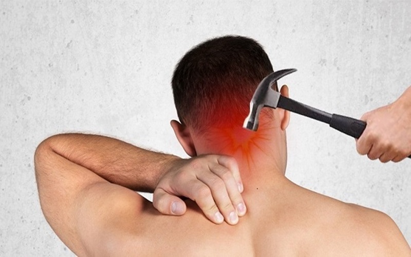 Hình ảnh đau đầu Sau Gáy ở Bệnh Nhân