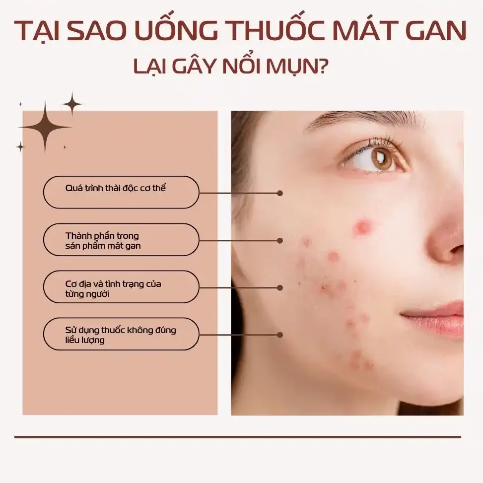 Tại Sao Uống Thuốc Mát Gan Lại Gây Nổi Mụn