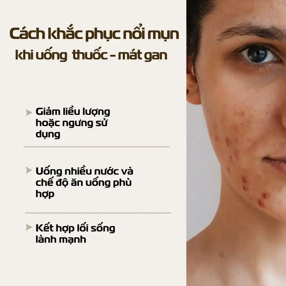 Tại Sao Uống Thuốc Mát Gan Lại Gây Nổi Mụn3