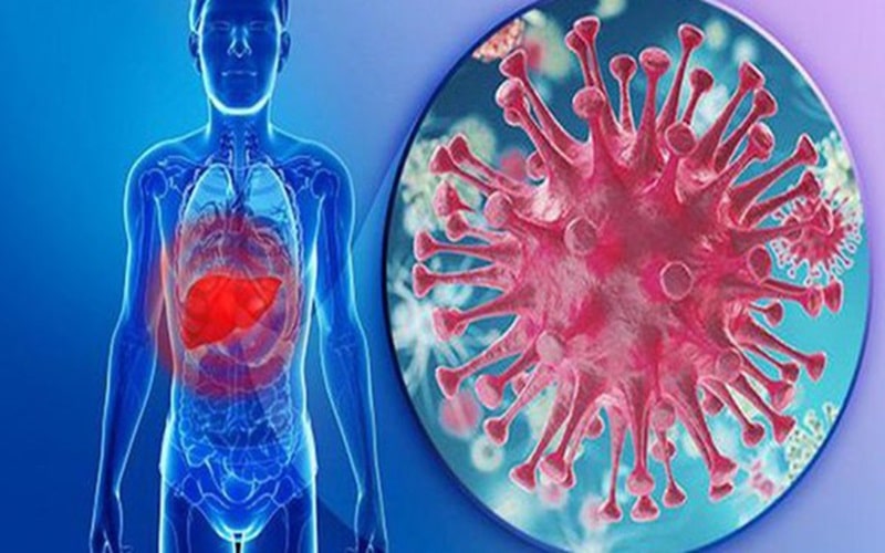 Xơ Gan ứ Mật Nguyên Phát 2