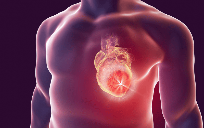 Nhồi máu cơ tim khác đột quỵ ở nhiều triệu chứng Nhồi máu cơ tim khác đột quỵ ở nhiều triệu chứng