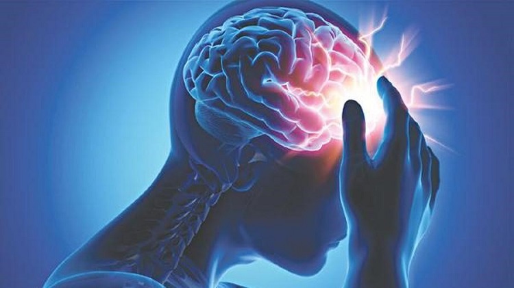 Đột Quỵ Là Gì? Nguyên Nhân Và Cách Phòng Tránh Hiệu Quả