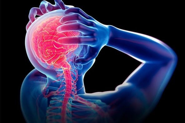 Đột Quỵ Não Là Gì? Nguyên Nhân Triệu Chứng Cần Biết