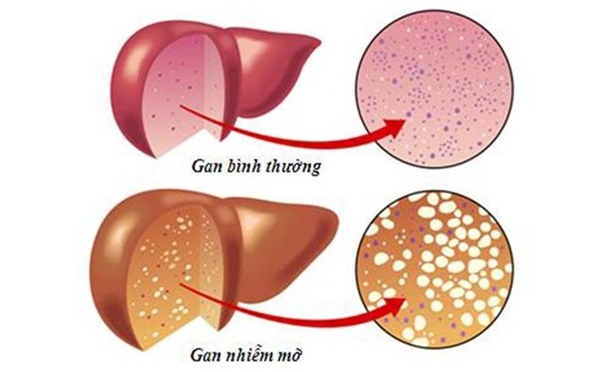 Gan yếu làm sao tăng cường sức khỏe đúng cách, hiệu quả?
