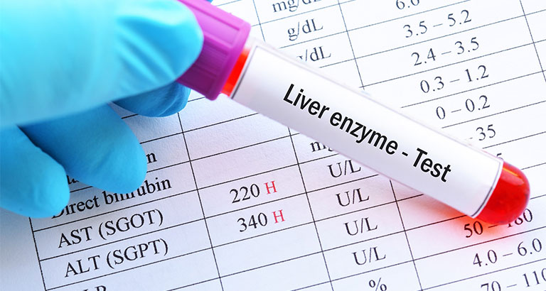 Kiểm tra chức năng gan định kỳ bao lâu một lần là hợp lý?