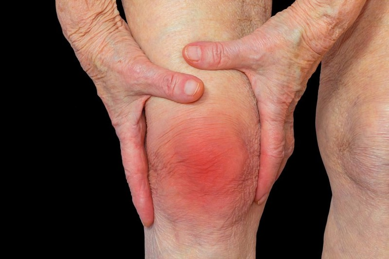 Ứng dụng của rễ cây móng quỷ với xương khớp