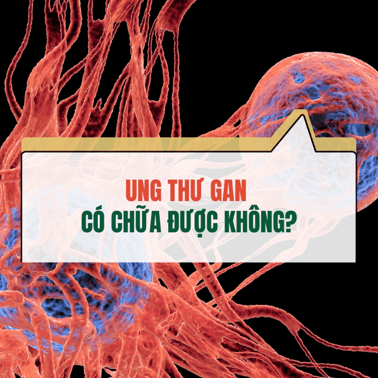 Ung Thu Gan Co Chua Duoc Khong Giai Dap Tu Chuyen Gia