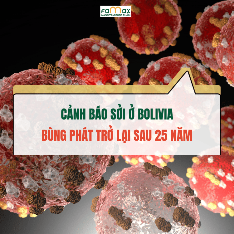 Dịch sởi bùng phát ở Bolivia sau 25 năm