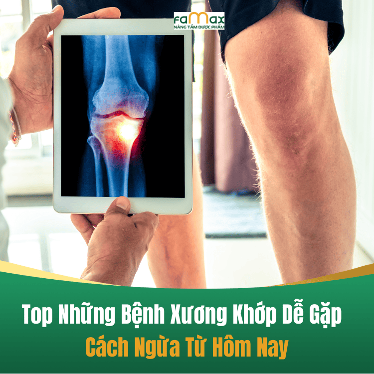 Các Loại Bệnh Xương Khớp Thường Gặp1