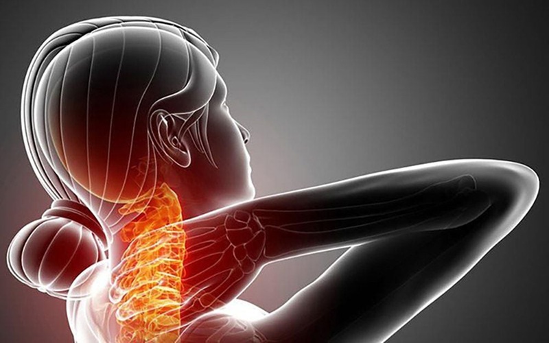 Các Phương Pháp Trị Liệu Cổ Vai Gáy Tốt Nhất Hiện Nay 1