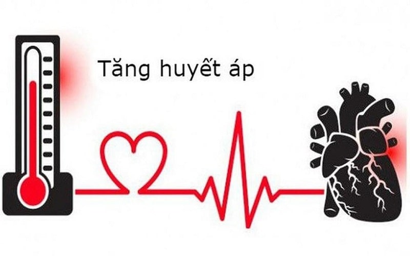 Đột Quỵ Và Tai Biến 3