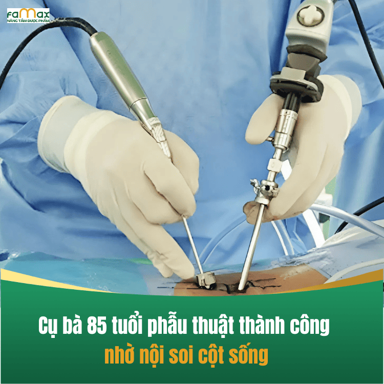 Phương pháp phẫu thuật nội soi cột sống