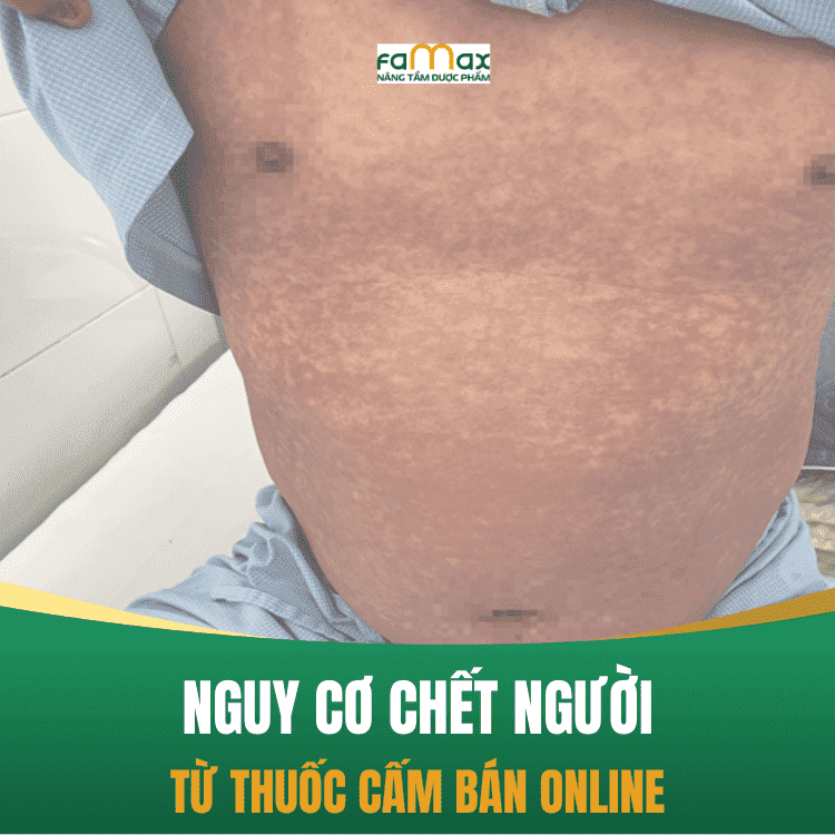 Canh Bao Thuoc Phenylbutazone Bi Cam Luu Hanh