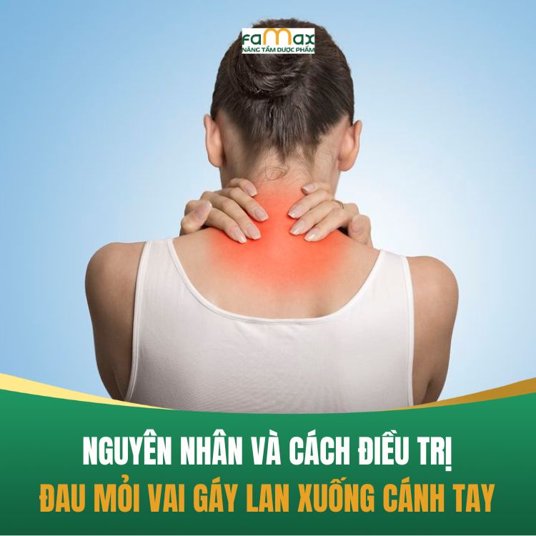 Dau Moi Vai Gay Thuong Xuyen Va Cach Dieu Tri