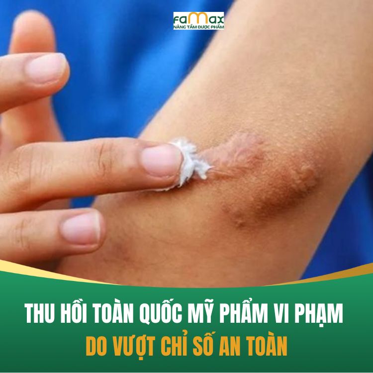 Thu Hoi My Pham Vi Phạm