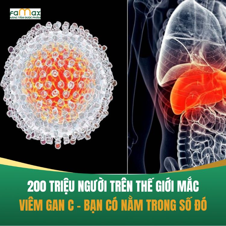 200 Trieu Nguoi Tren The Gioi Mac Viem Gan C Ban Co Nam Trong So Do 68d2225d4dfa3.webp