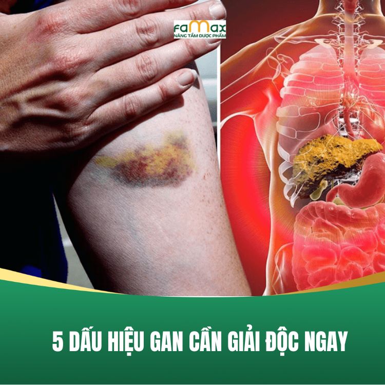 5 Dau Hieu Gan Can Giai Doc Va Cach Ho Tro Hieu Qua 68bea5fde0420.webp