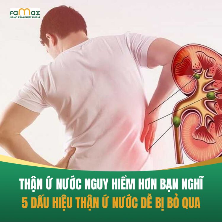 5 Dau Hieu Than U Nuoc Ai Cung De Bo Qua 68d2499ed7dfa.webp