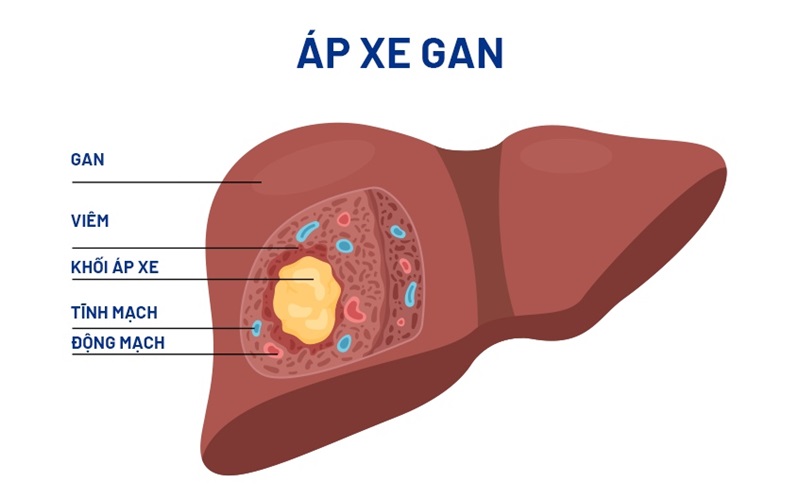 Ap Xe Gan La Gi