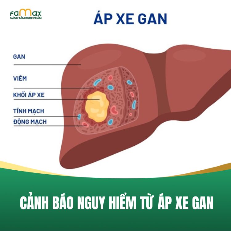 Ap Xe Gan Trieu Chung