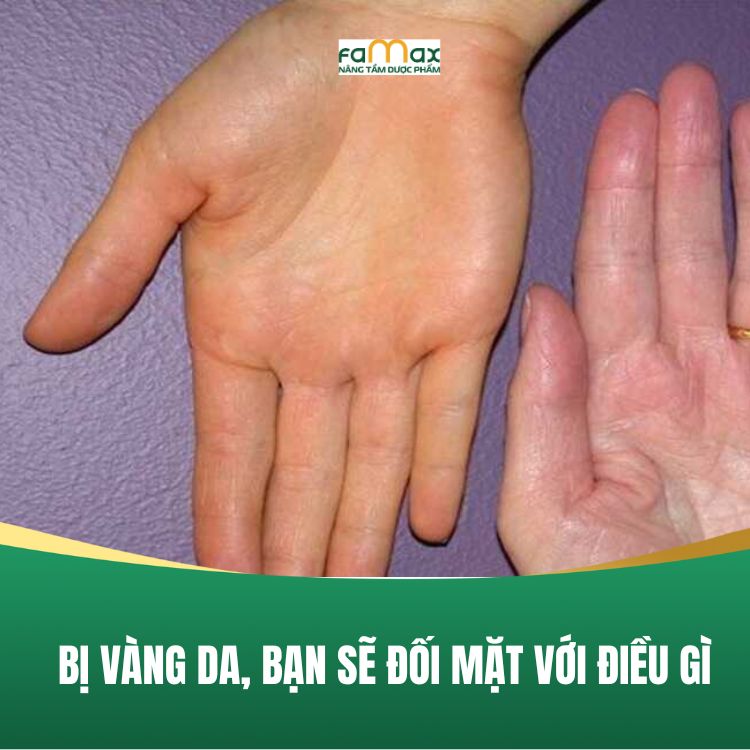 Bi Vang Da Ban Se Doi Mat Voi Dieu Gi 68be94e73401a.webp
