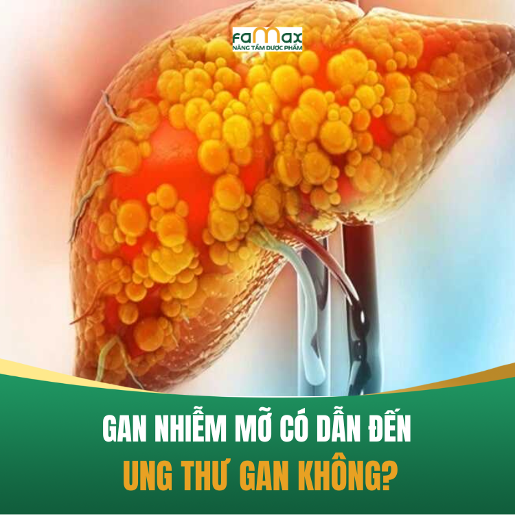 Gan Nhiem Mo Co Dan Den Ung Thu Gan 68cb92b190831.webp