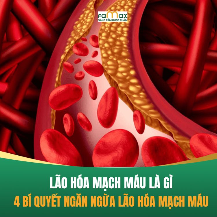 Lao Hoa Mach Mau La Gi 4 Bi Quyet Ngan Ngua Lao Hoa Mach Mau 68ce13a7c5a6a.webp