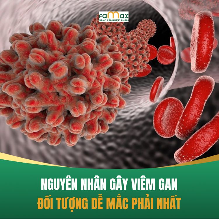Nguyen Nhan Gay Viem Gan La Gi
