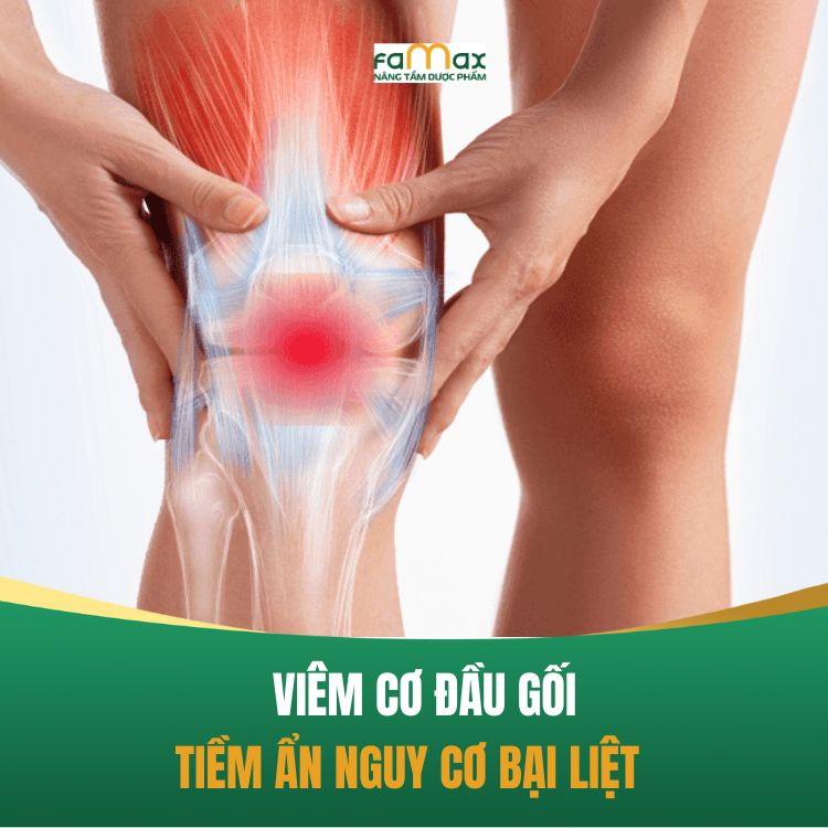Viem Co Dau Goi Nguyen Nhan Trieu Chung 68bbdcb62f9a1.webp