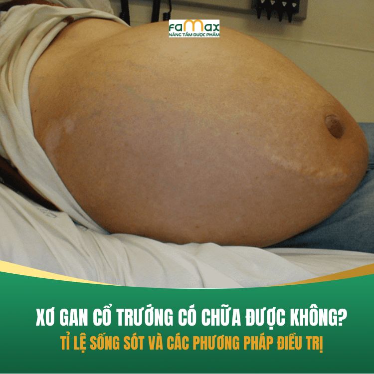 Xo Gan Co Truong Co Chua Duoc Khong 68cbc0c9bba92.webp