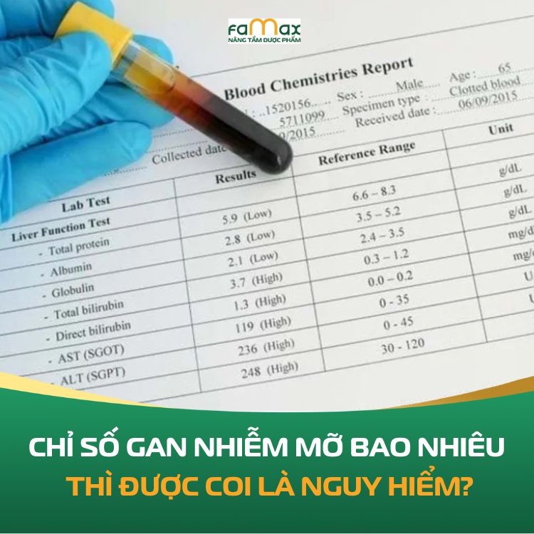 Chi So Gan Nhiem Mo Do 1 Nhan Biet Dieu Tri Va Phong Ngua Hieu Qua 68e72983936de.webp