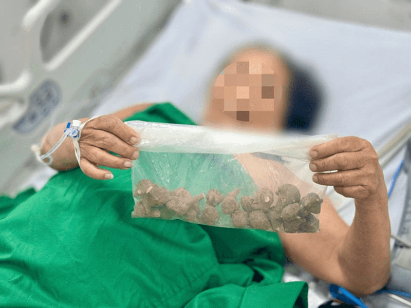 Ngo Doc Cu Au Tau Chua Khop