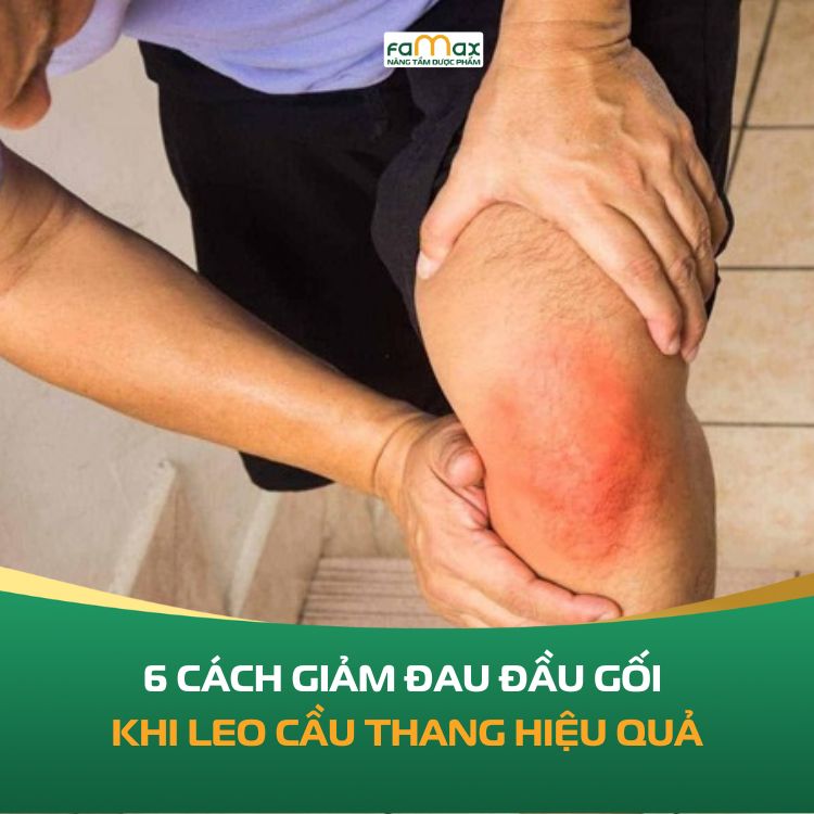 6 Cach Giam Dau Dau Goi Khi Leo Cau Thang 6909ad900e173.webp