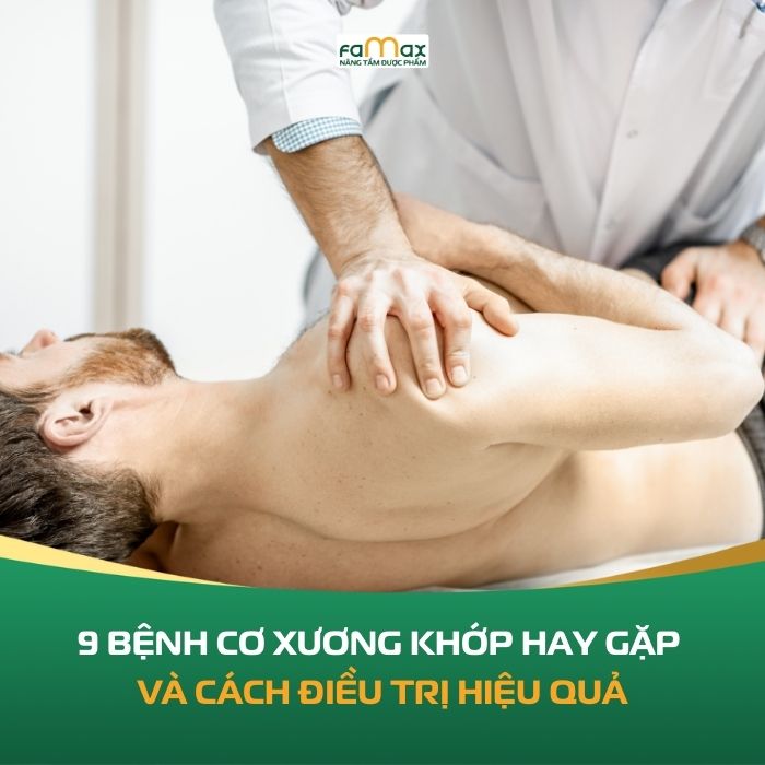 9 Benh Co Xuong Khop Hay Gap Nhat Va Cach Dieu Tri Hieu Qua 694117798dcf4.webp
