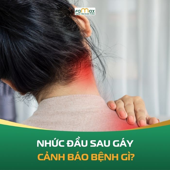Nhuc Dau Sau Gay Canh Bao Benh Gi 692d6bd6ddddc.webp