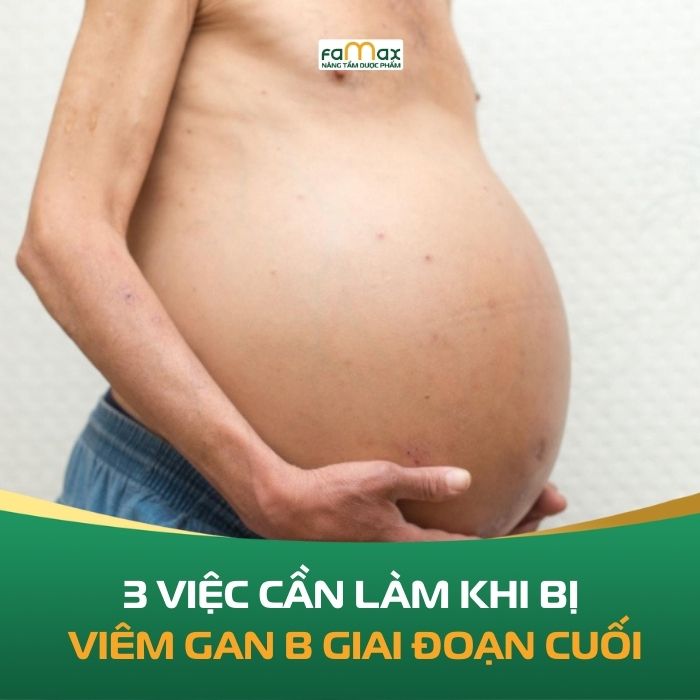 3 Viec Can Lam Khi Bi Viem Gan B Giai Doan Cuoi 6969a5cd32c1c.webp