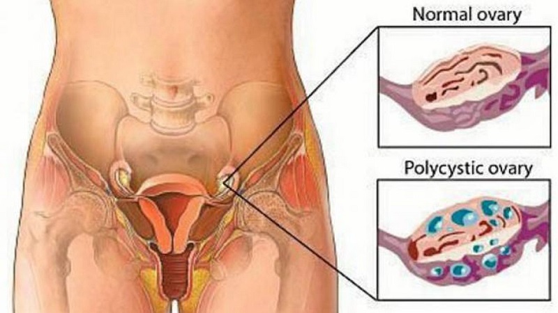 Phu Nu Nhieu Nguoi Den Giai Doan Rung Trung Se Dau