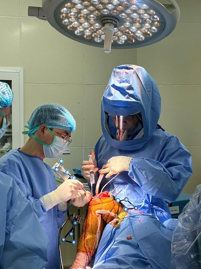 Phau Thuat Khopp Goi 1 17684761325031074678292