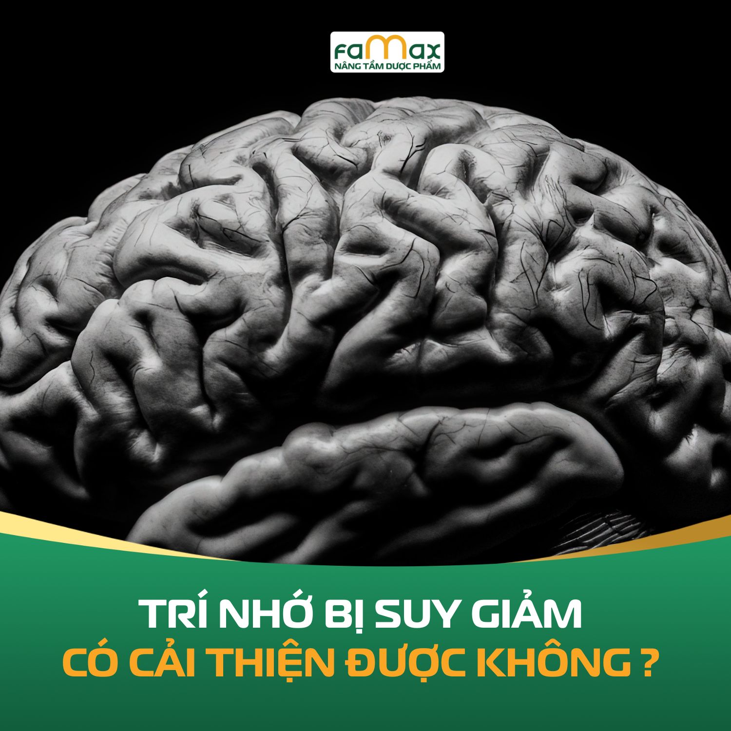 Tri Nho Bi Suy Giam Co Cai Thien Duoc Khong Nhung Thoi Quen Nen Thay Doi Som 697c2294ea1e6.webp